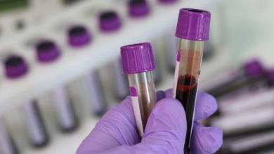 Using Blood Samples to Detect Positive COVID-19 Cases in 20 minutes - AppliedHE