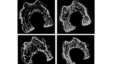 UM develops new biomaterial that can enhance bone grafting efficacy - AppliedHE