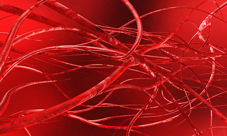 A quicker and less invasive way to seal up broken blood vessels - AppliedHE