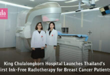 King Chulalongkorn Memorial Hospital Introduces Thailand’s First Ink-Free Radiotherapy for Breast Cancer - AppliedHE