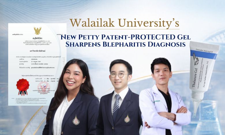 Walailak University Develops Petty Patent-Protected Gel for Improved Blepharitis Diagnosis - AppliedHE