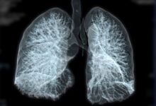 Advancing Tuberculosis Vaccines Through Lung-Focused Immunity Research - AppliedHE