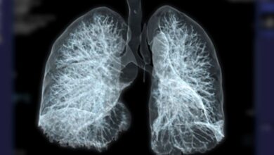 Advancing Tuberculosis Vaccines Through Lung-Focused Immunity Research - AppliedHE