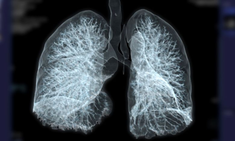 Advancing Tuberculosis Vaccines Through Lung-Focused Immunity Research - AppliedHE